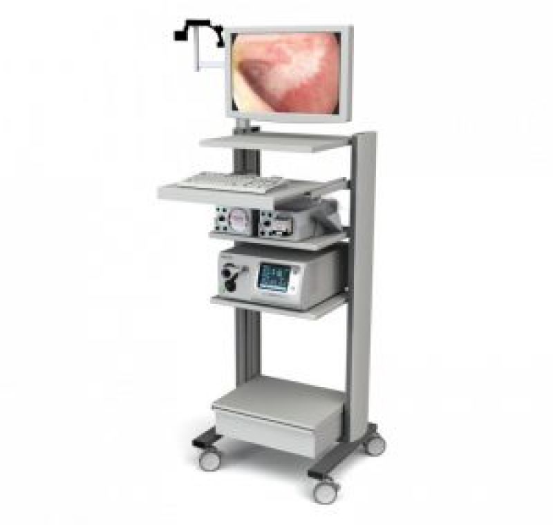 endoscopie